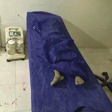 قربانی کوچک حمله آمریکا؛ عروسی‌ای که به عزا نشست